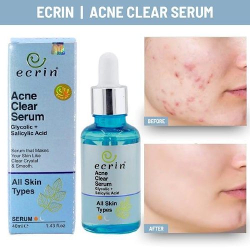 Acne Clear Serum Price In Pakistan