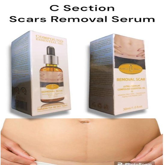 Acne Scar Removal Rejuvenation Serum, 30 Ml