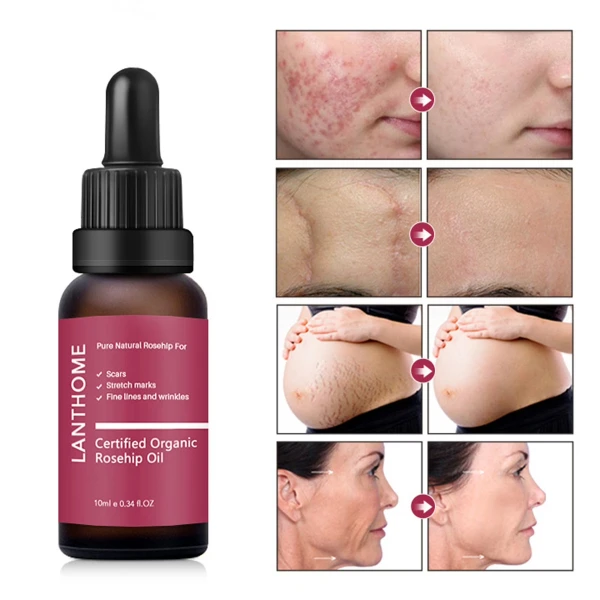 Lanthome Rosehip Oil In Pakistan