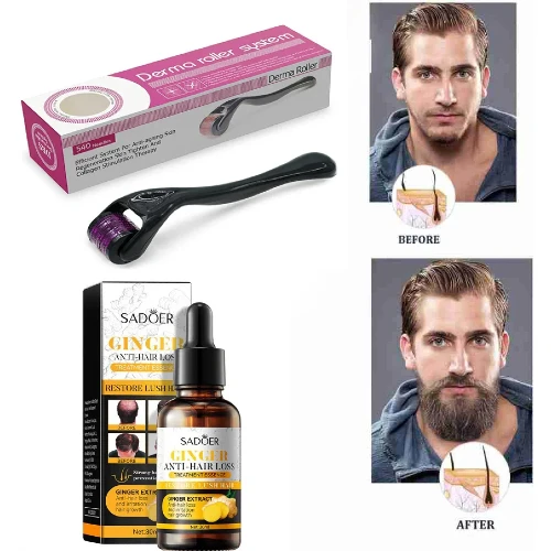 Anti Hair Loss Shampo Anti Hair Loss Essential And Needle Roller Bundle