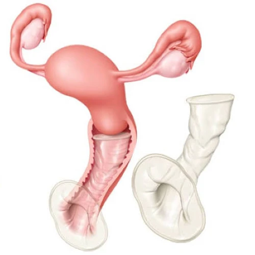 Female Condoms In Pakistan