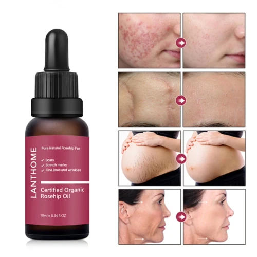 Lanthome Rosehip Oil In Pakistan