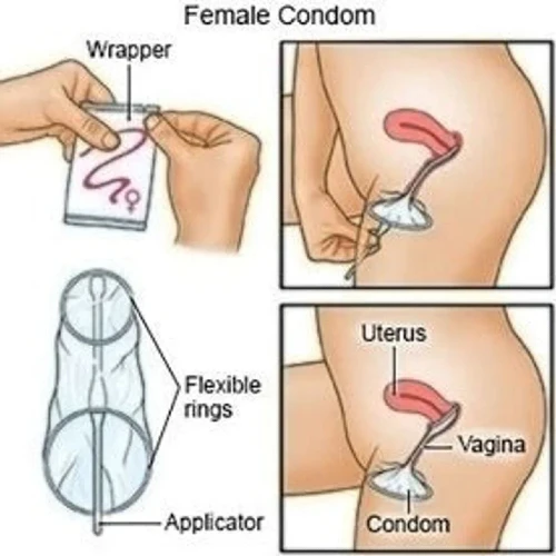 Simplex - Cobra Female Condom
