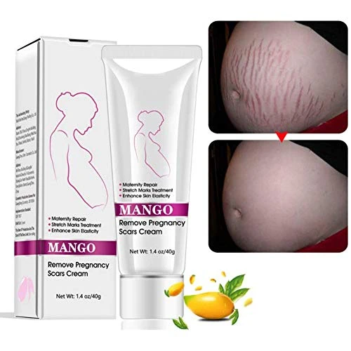 Stretch Marks Cream In Pakistan