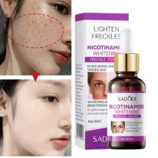 SADOER Nicotinamide Whitening Freckles Serum 30ml